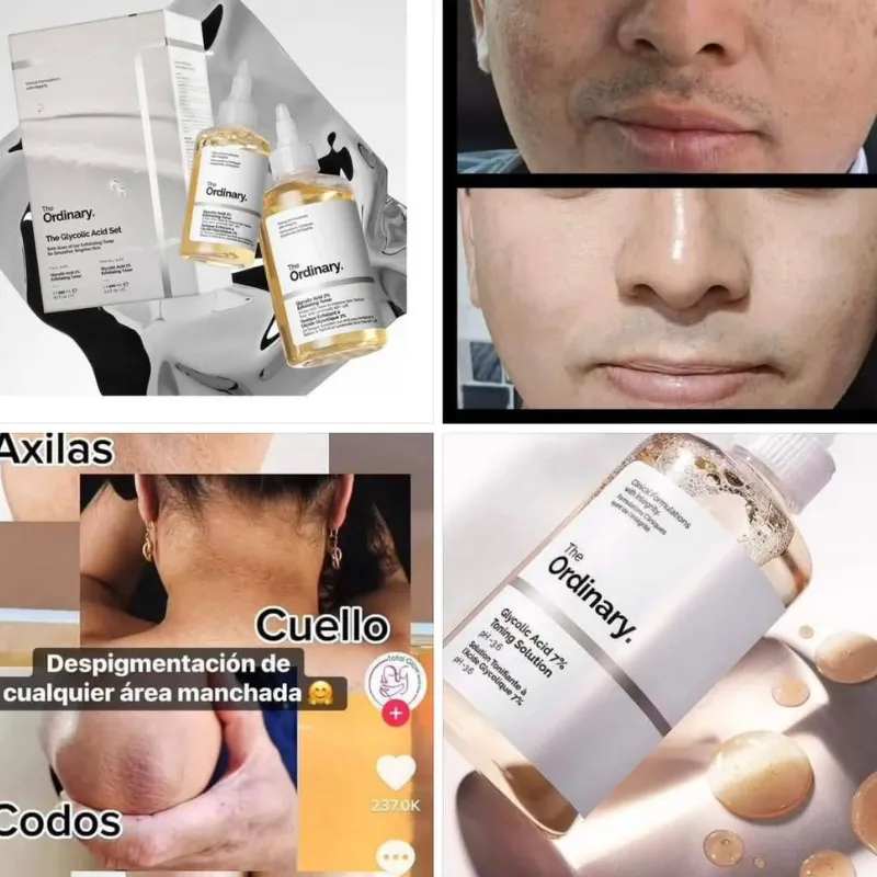 ✨Tónico Exfoliante Ácido Glycolico✨