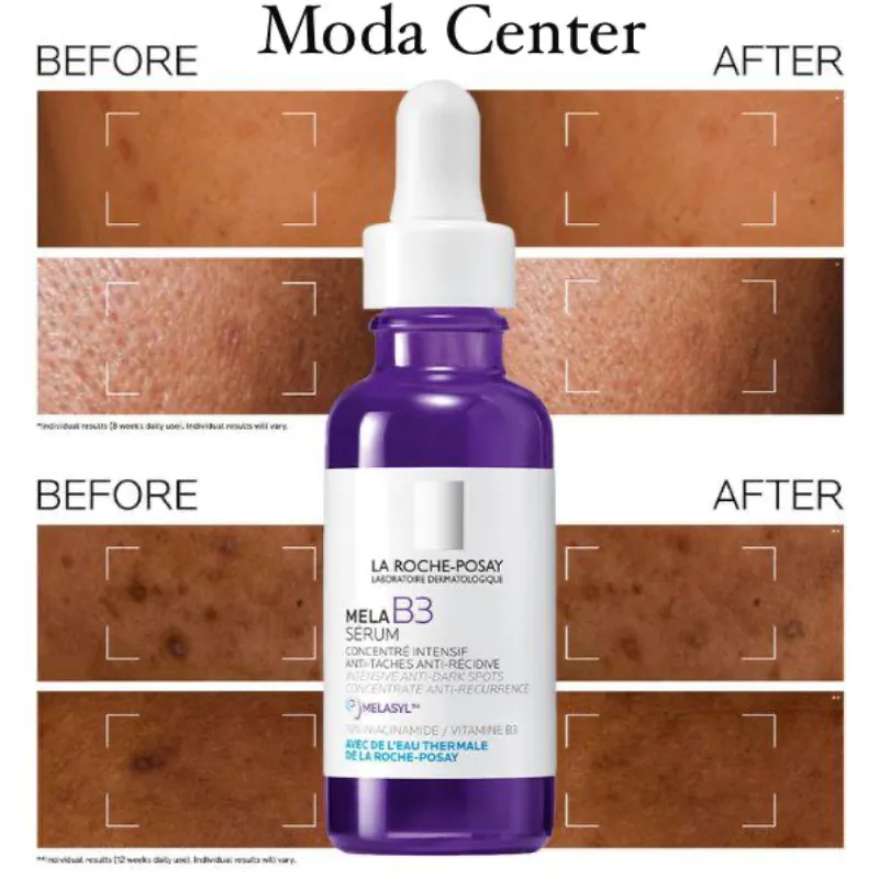 Sérum Intensivo Anti-Manchas y Anti-Hiperpigmentación (La Roche Posay)