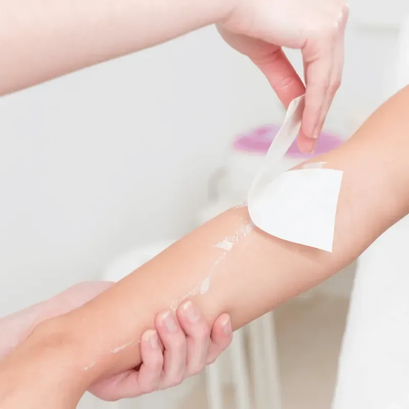 Arm hair removal with wax