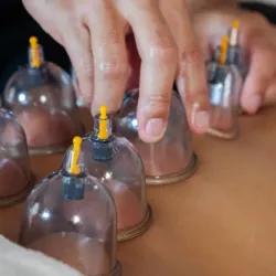Cupping therapy (75min)