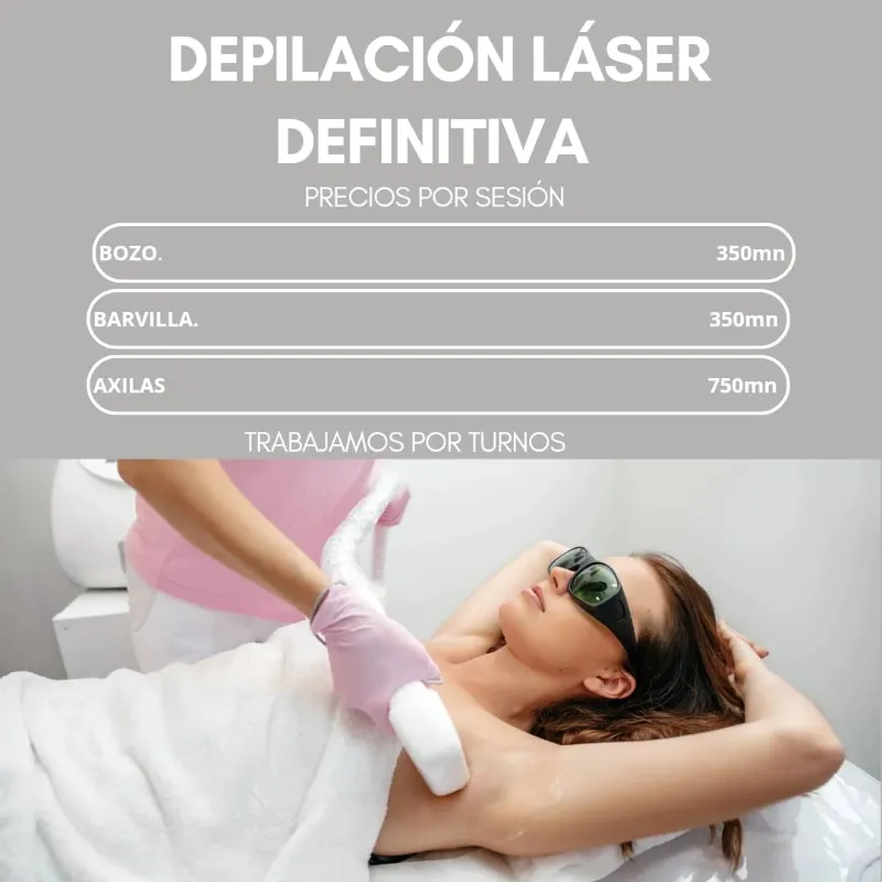 Depilación laser 