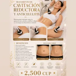 Tratamiento de Cavitacion Reductora y Anticelulítis