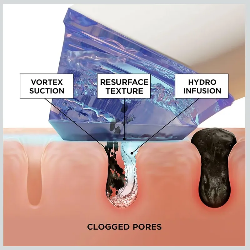 BeautyBio GLOfacial Hydro-Infusion Deep Pore Cleansing + Blue LED Clarifying Set: Herramienta + Concentrado