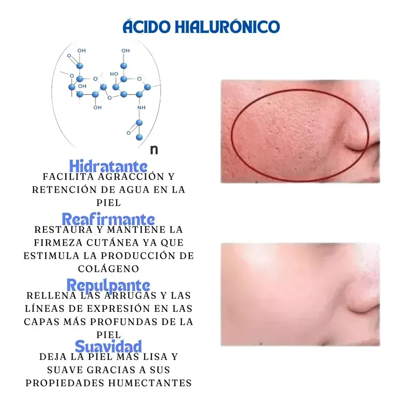 Ampolletas Faciales de Ácido Hialurónico