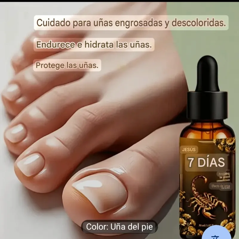 Tratamiento para las uñas de los pies