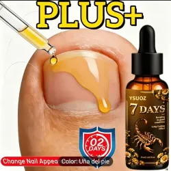Tratamiento para las uñas de los pies