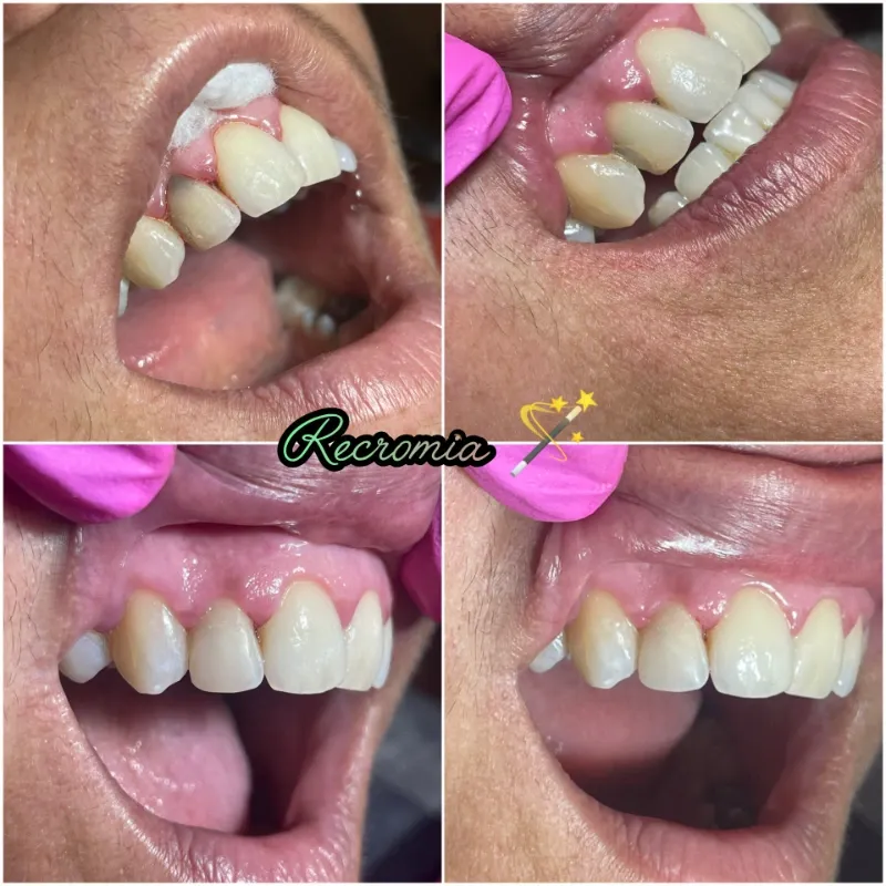Recromia