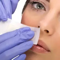 DEPILACIÓN DE ESBOZO (BIGOTE) CON CERA