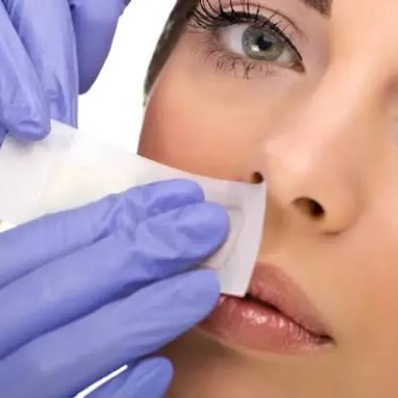 DEPILACIÓN DE ESBOZO (BIGOTE) CON CERA