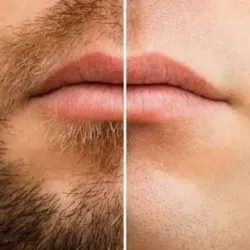 DEPILACIÓN FACIAL COMPLETA CON CERA