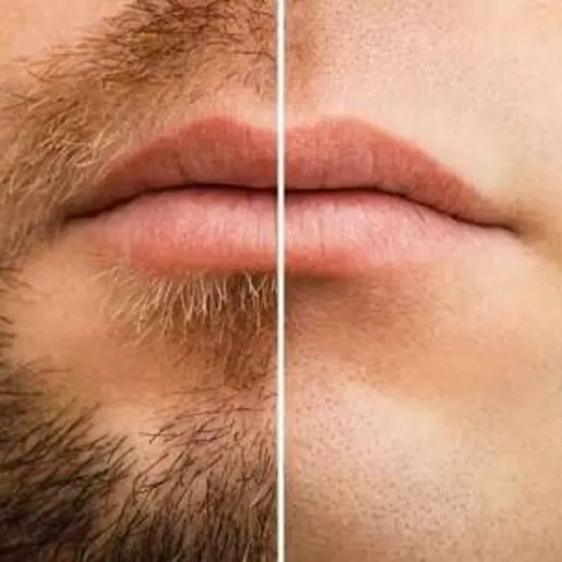 DEPILACIÓN FACIAL COMPLETA CON CERA