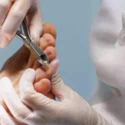 Eliminación de cutículas