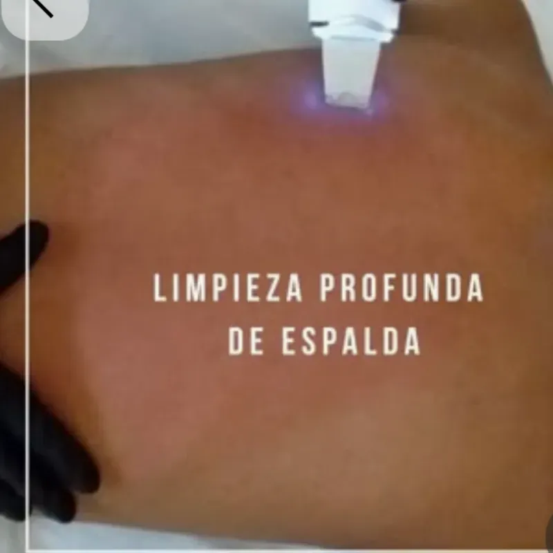 Limpieza profunda de espalda