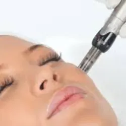 REJUVENECIMIENTO FACIAL CON DERMAPEN (sesión en rostro)