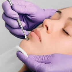 Limpieza facial profunda.