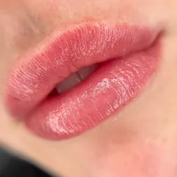 Microneedling de labios o Hydralips.