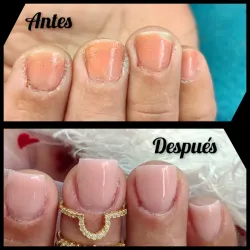 Extensión con base Ruber 