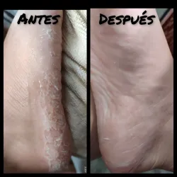 Pedicura spa 