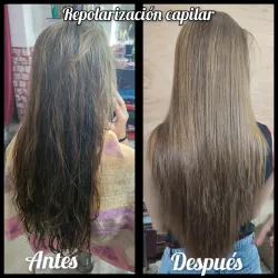 Repolarización capilar 