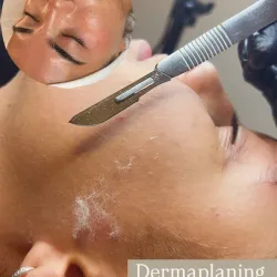Dermaplaning