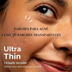 Parches transparentes del acné