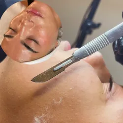 Dermaplaning