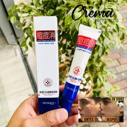 Crema Anti acne de Bioaqua 