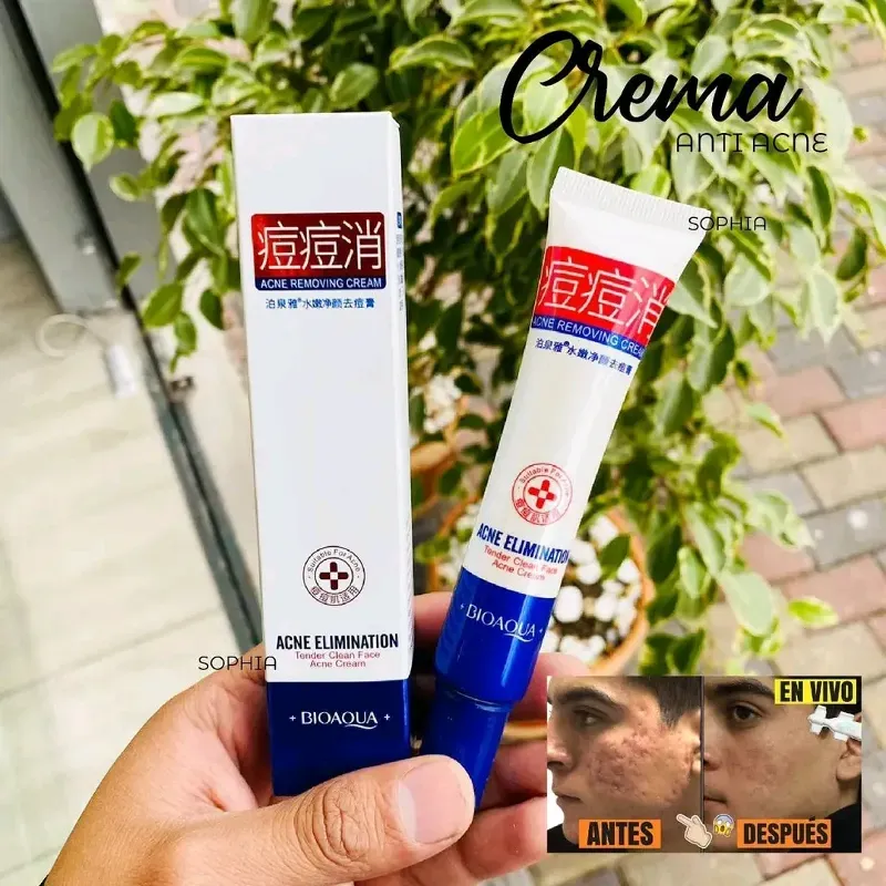 Crema Anti acne de Bioaqua 