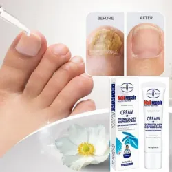 Crema Anti Hongos para las uñas 