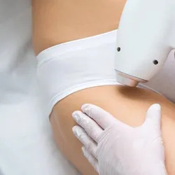 DEPILACIÓN LÁSER PELVIS