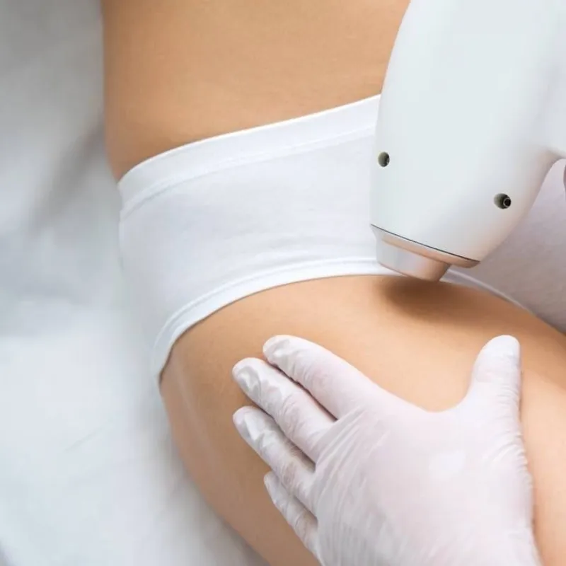 DEPILACIÓN LÁSER PELVIS