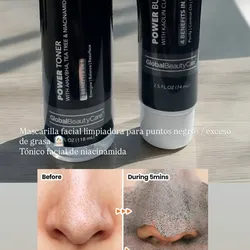 Mascarilla para puntos negros