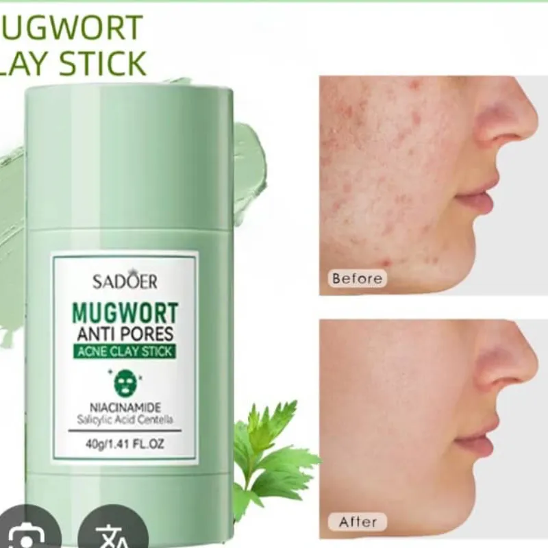 Máscara de arcilla para el acné