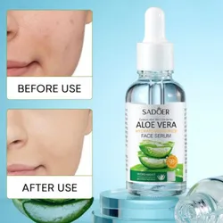 Serum Aloe Vera Sadoer 