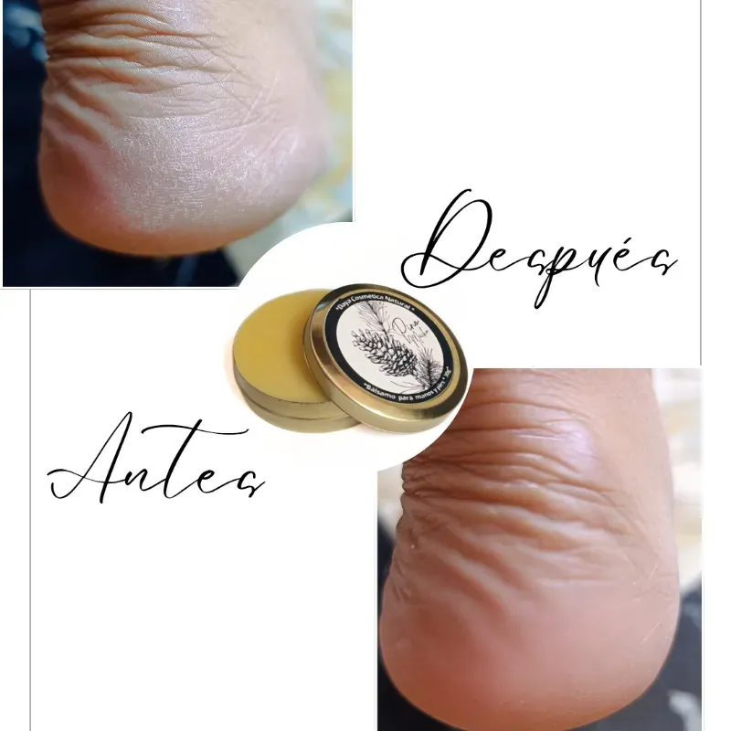 Bálsamo de Pino Macho 30g