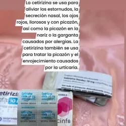 Cetirizina