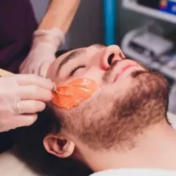Depilación de Barba en hombres