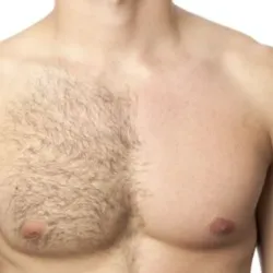 Depilación de Pecho, Espalda y Abdomen