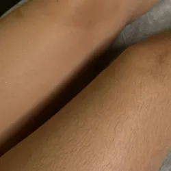 Depilación Piernas y Muslos