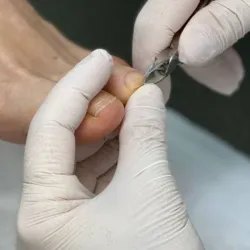Hidroterapia con pedicura relajante 