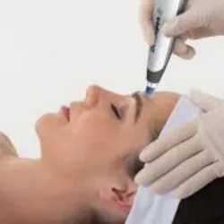 Tratamiento antiedad MICRONEEDLING con Dermapen