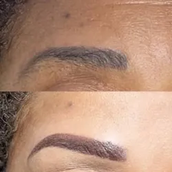 Neutralización de Cejas