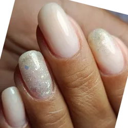 Reforzamiento en gel