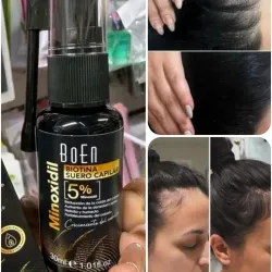 Minoxidil con biotina