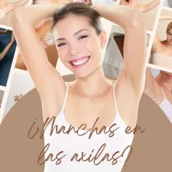 DESPIGMENTACION DE ZONAS MANCHADAS