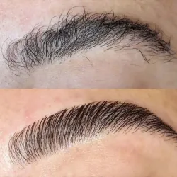 LAMINADO DE CEJAS + BOTOX