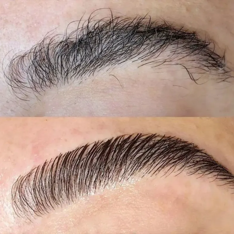 LAMINADO DE CEJAS + BOTOX