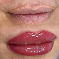 MICROPIGMENTACIÓN DE LABIOS CON DRPEN