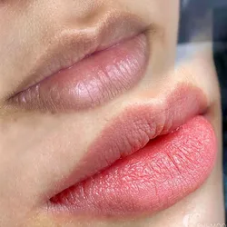 Neutralización de Labios