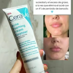 Limpiador Cerave con peróxido de benzoilo 4 % antiacné 